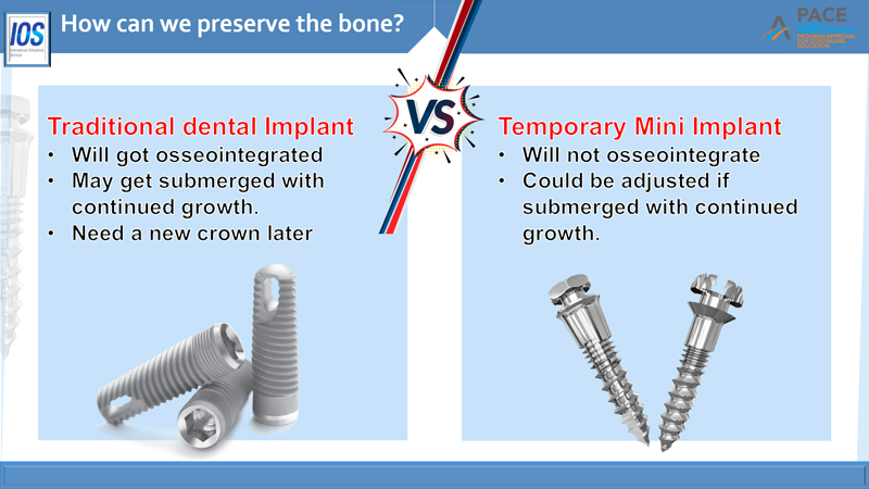 Temporary dental Implant manufacturer