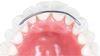 Picture of Lingual Retainers 3& 3 22 mm - PK/2