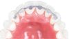Picture of Lingual Retainers 3To 3 32 mm Upper Size - PK/2