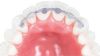 Picture of Lingual Retainers 3To 3 29 mm Lower Size - PK/2
