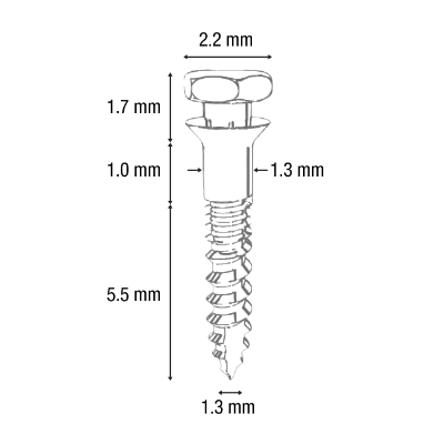 IOS Ortho. Infinity Mandibular Implant L 7.5 mm - Piece