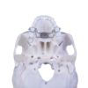 Picture of Infinity Expander 7 mm - Piece
