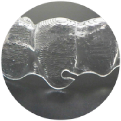 IOS Ortho. The Tear Drop - Piece