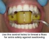 Picture of Disposable Tongue Block Large - PK/10