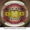 Picture of Disposable Tongue Block Small - PK/10
